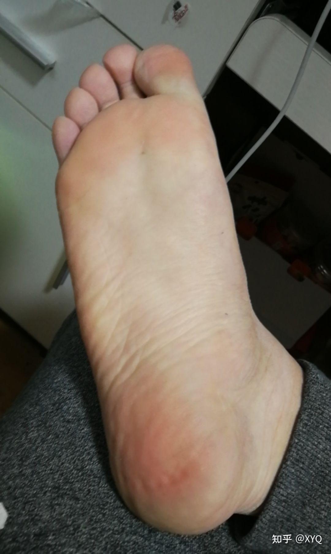 男孩子有一双好看的脚是一种什么样的体验