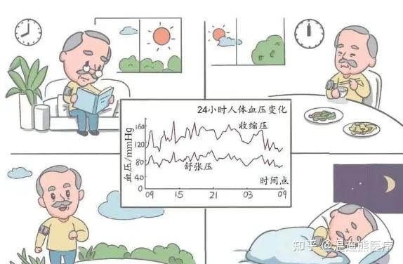 为什么医生建议你做24小时动态血压监测?看完就懂了! - 知乎