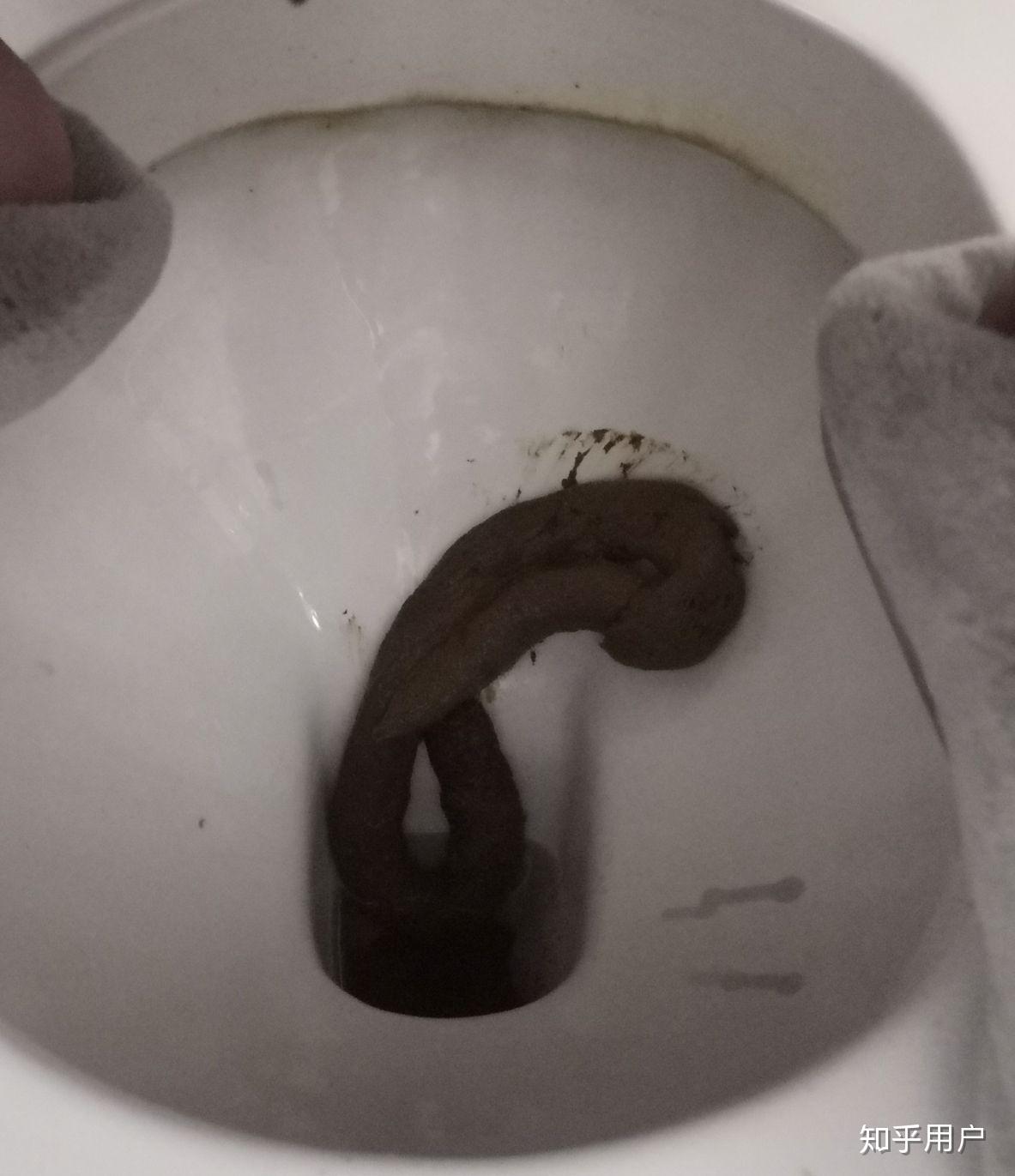 你拉过最长的屎有多长