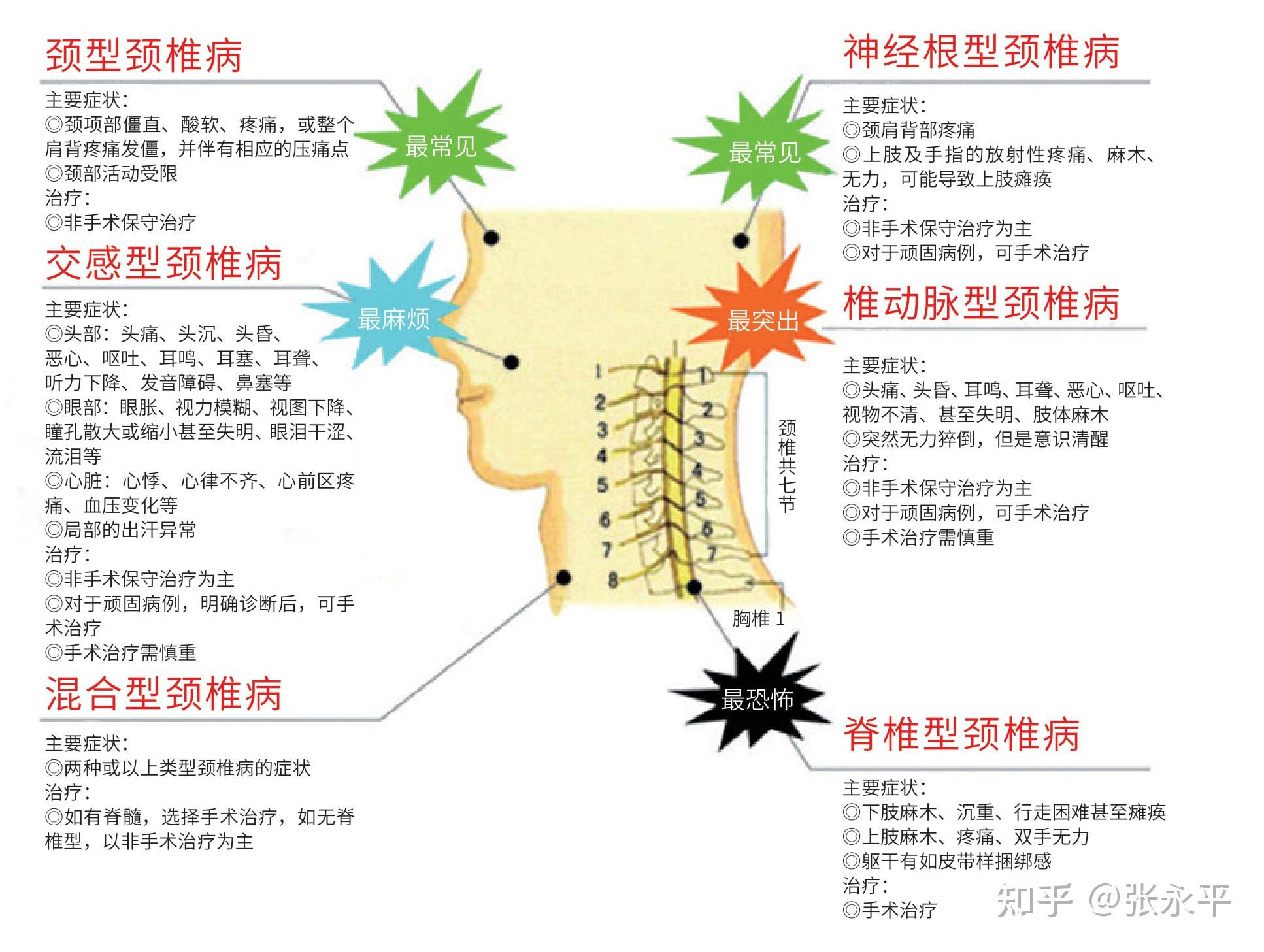 颈椎病早期的10大症状图片