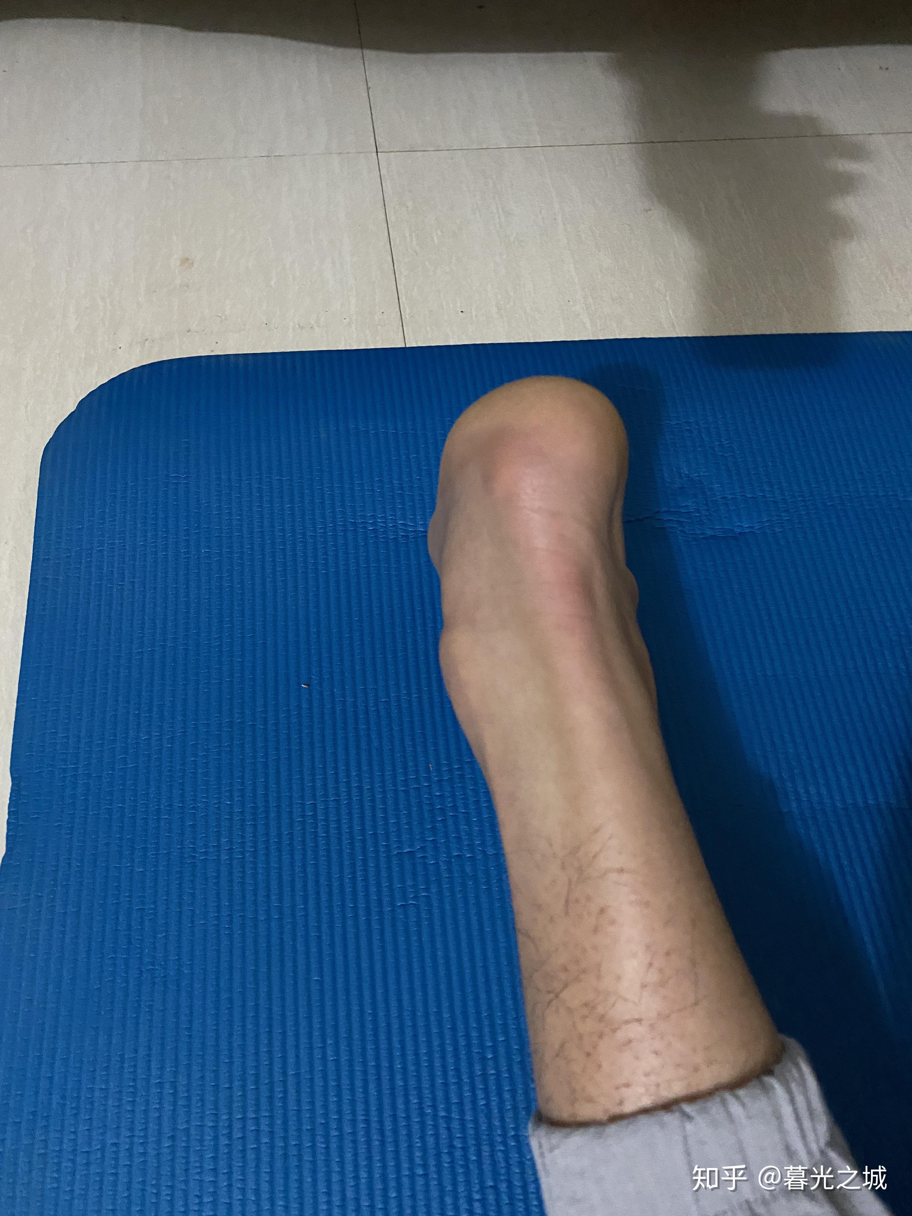 男生跟腱长是一种怎样的体验? - 知乎