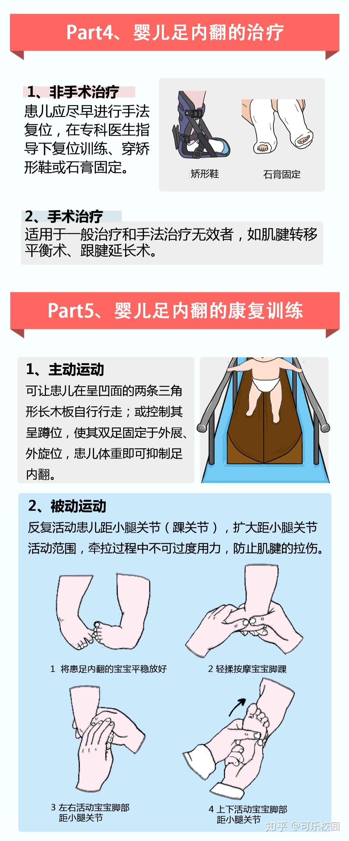 「内翻足」是怎么回事?有什么症状?如何治疗?
