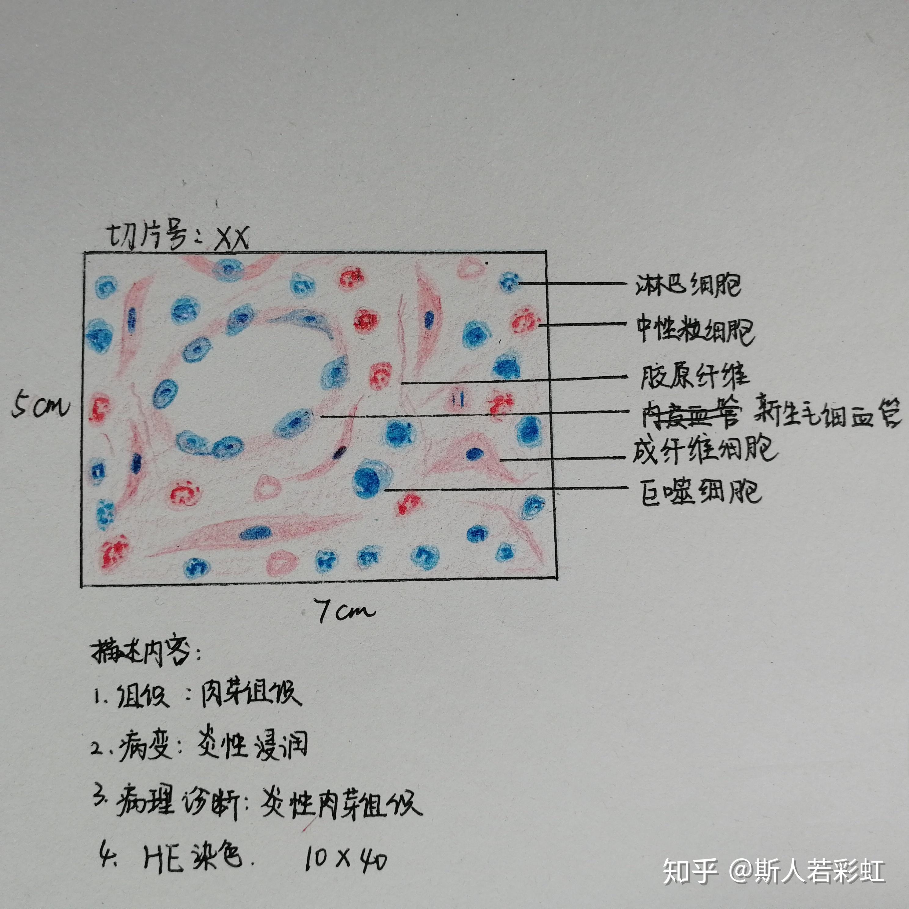 肉芽组织红蓝铅笔图图片