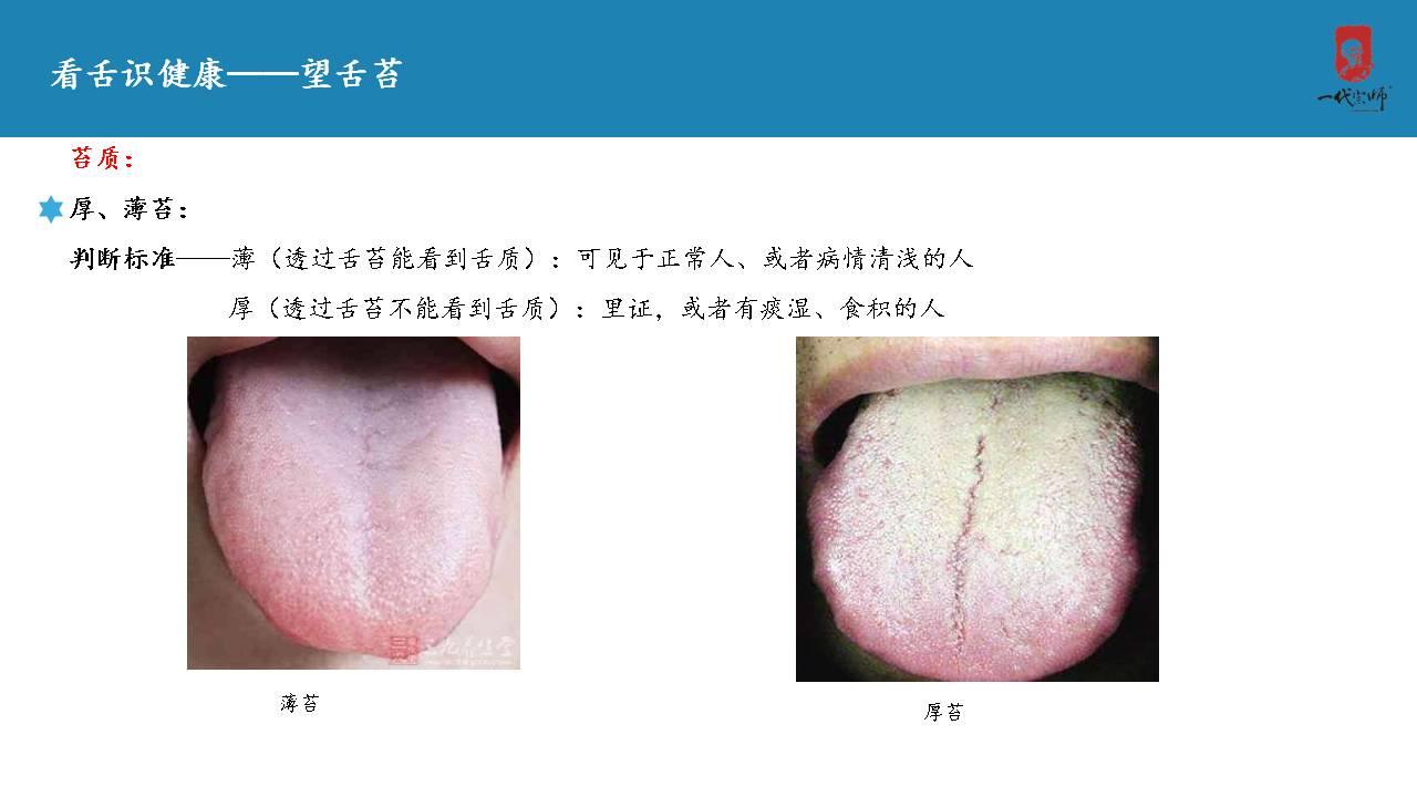 舌苔是什么？用来诊病有什么依据？ - 知乎