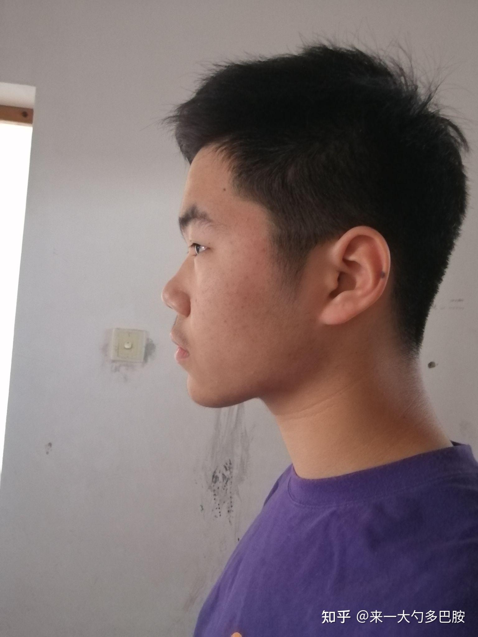 没有鼻梁鼻子塌的人是什么体验