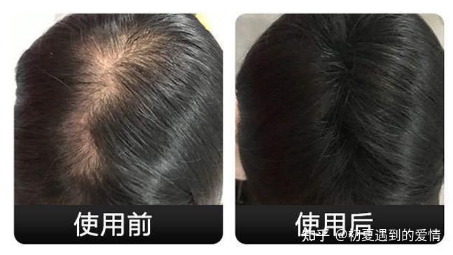 男士头顶发量稀少发型?不秃真的别碰,怕你用得发量超标! - 知乎