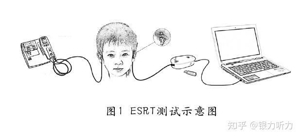 诺尔康人工耳蜗术后电诱发镫骨肌反射测试及临床应用