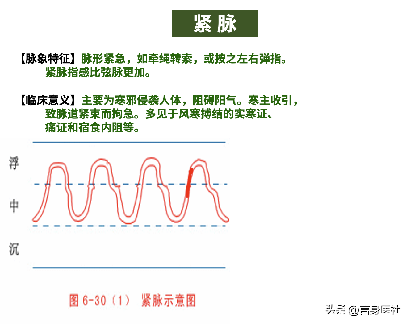 中医故事:促脉、结脉、代脉、弦脉和紧脉的合集 - 知乎