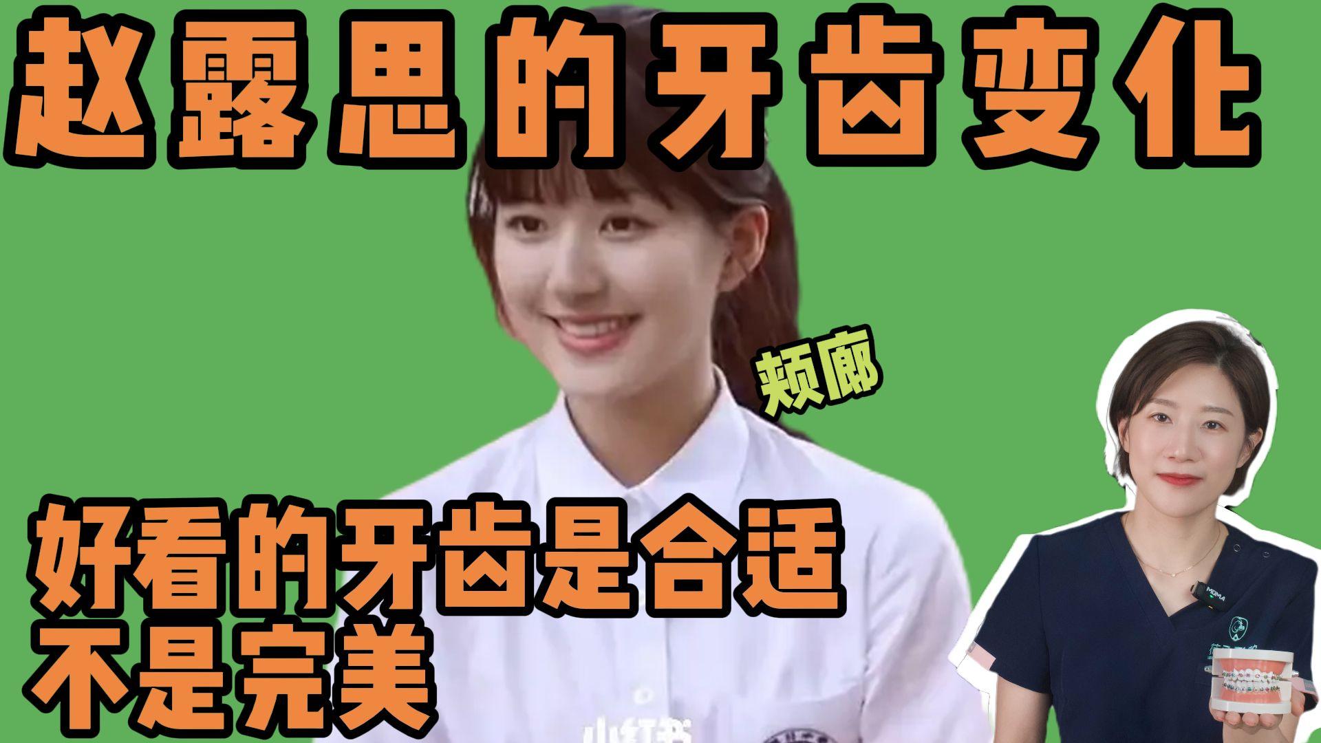 赵露思的牙齿矫正后有什么变化做牙齿真的能变美吗