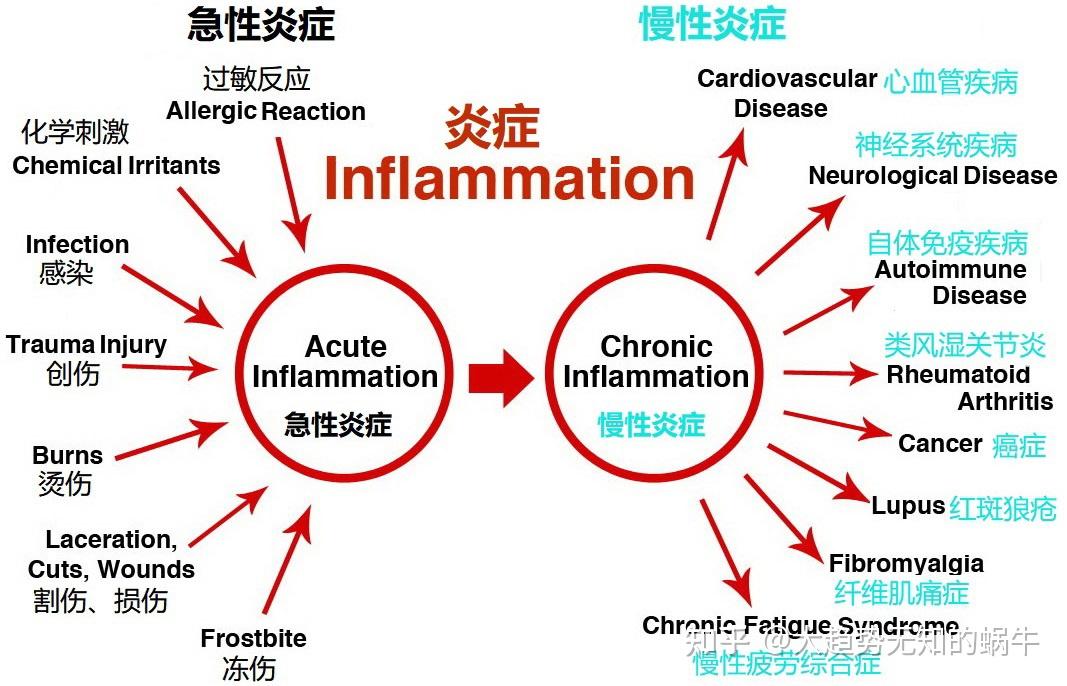 我们不知道答案的125个科学问题(77)慢性炎症 - 知乎