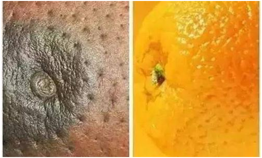 一般女生的乳晕大小? - 知乎