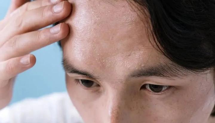 一动就满头大汗是啥虚?手心出汗、头部出汗、睡着出汗,你是哪种 - 知乎