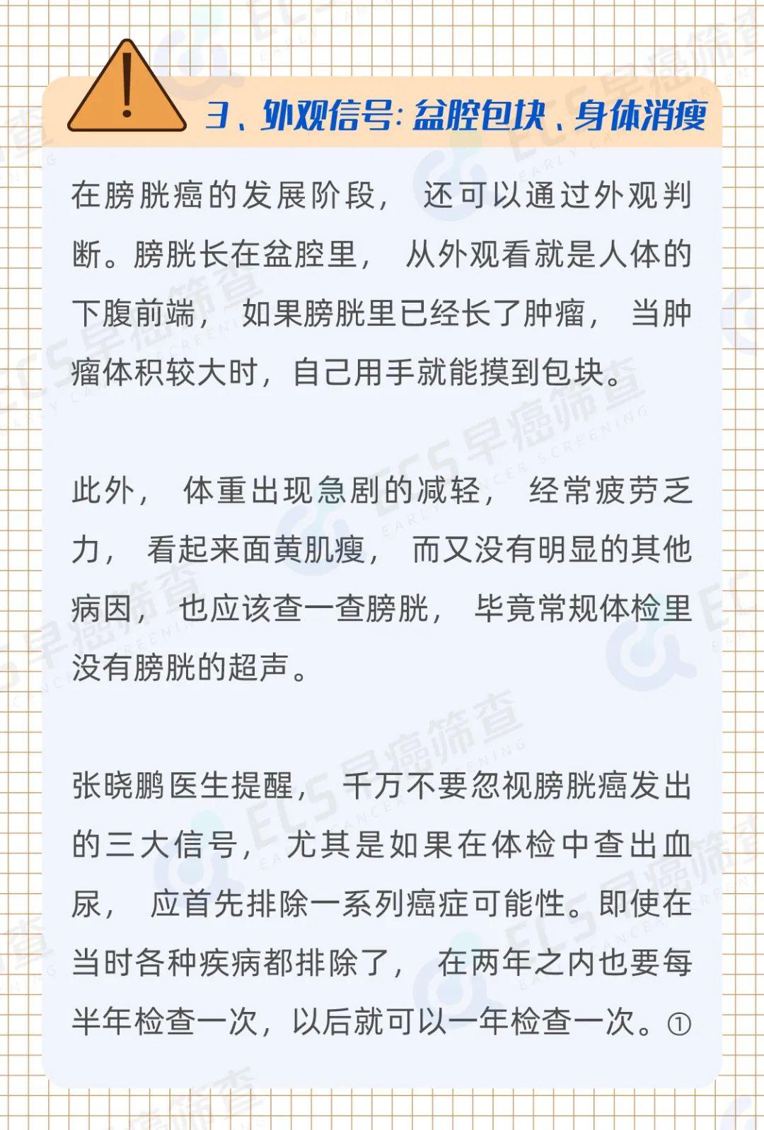 七十多岁的老年人得了膀胱癌会怎样? - 知乎