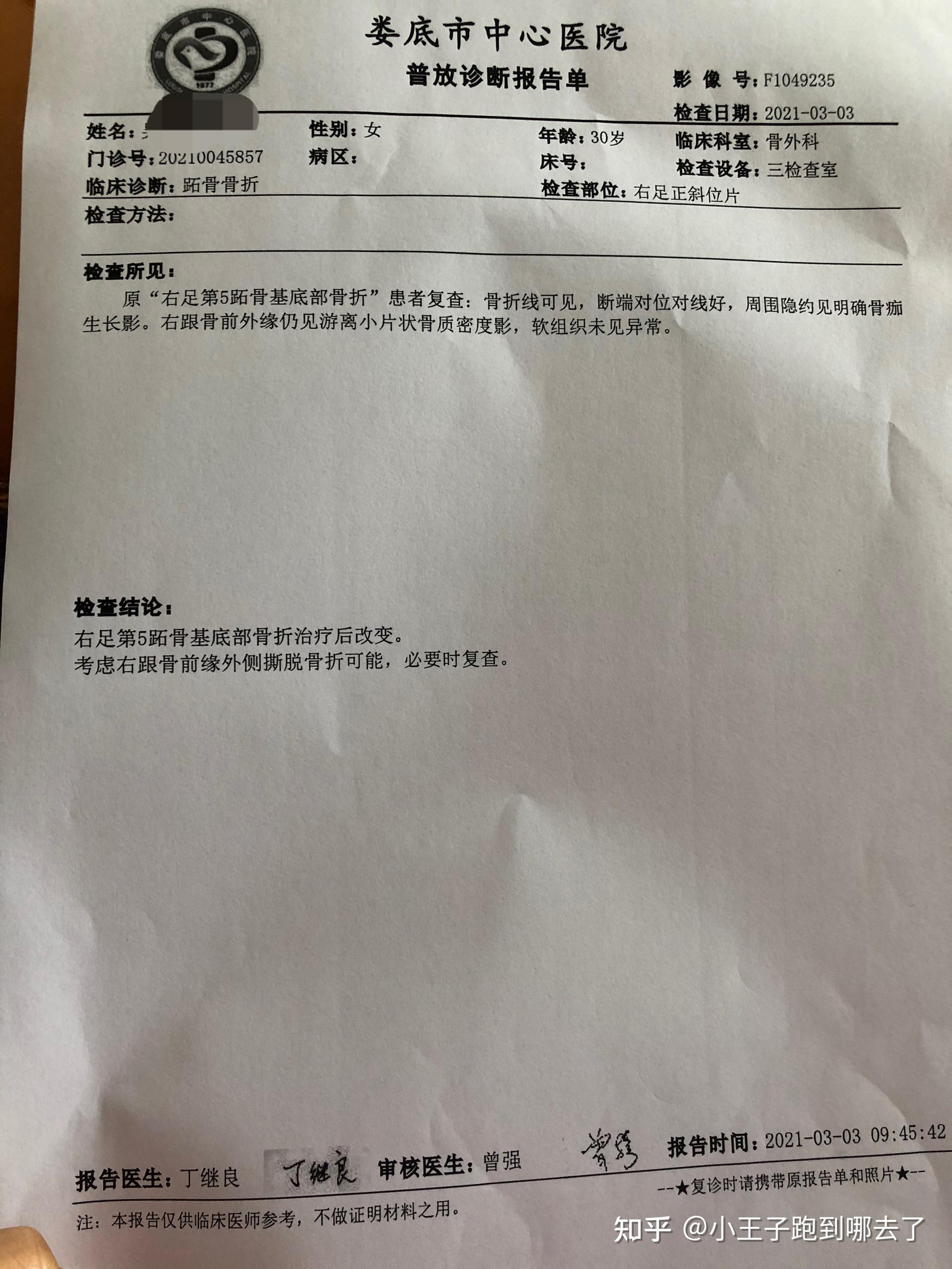 第五趾跖骨骨折多久可以走路? - 知乎