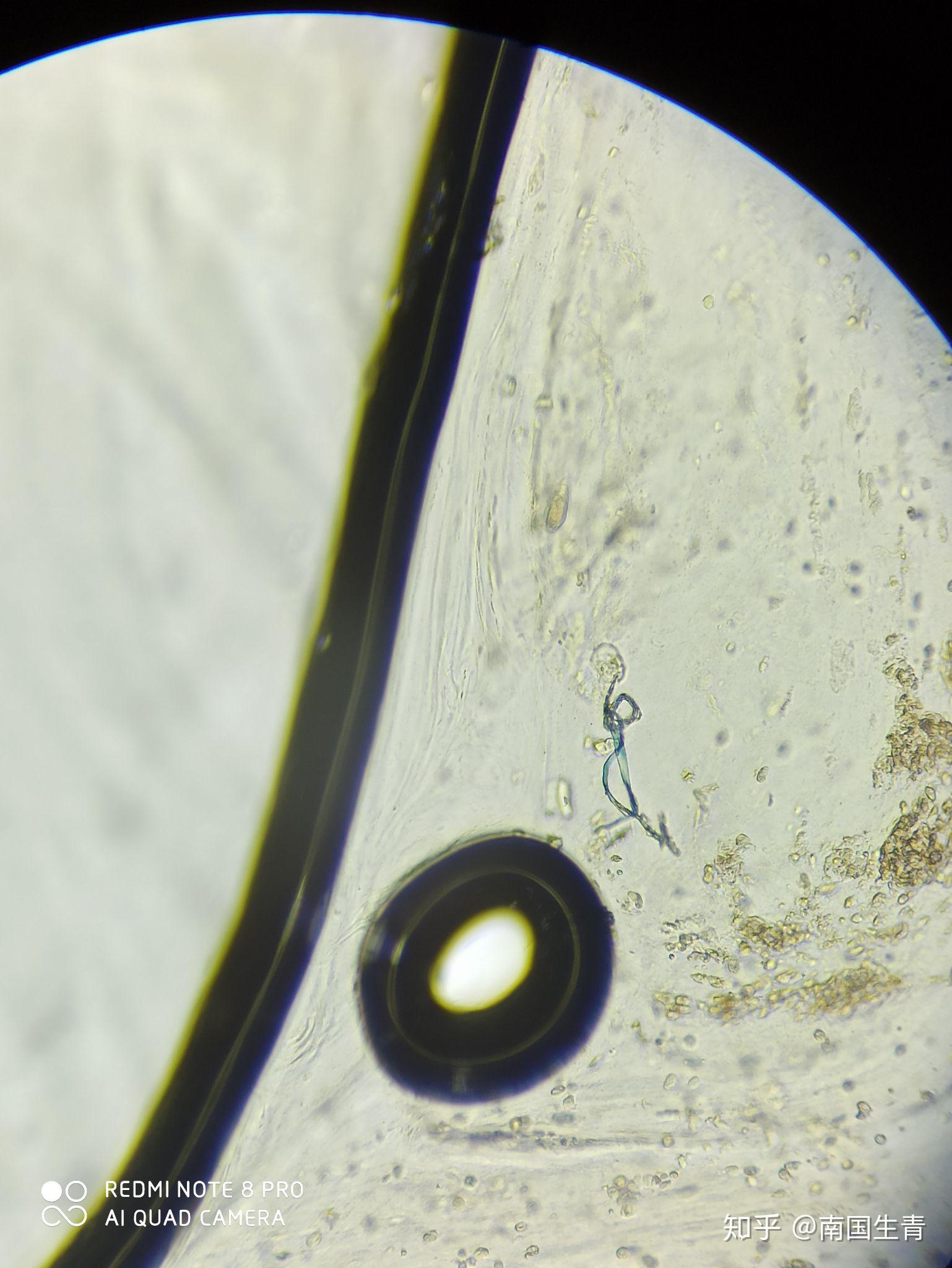 顯微鏡圖片與視頻請問這裡面有寄生蟲或者蟲卵嗎
