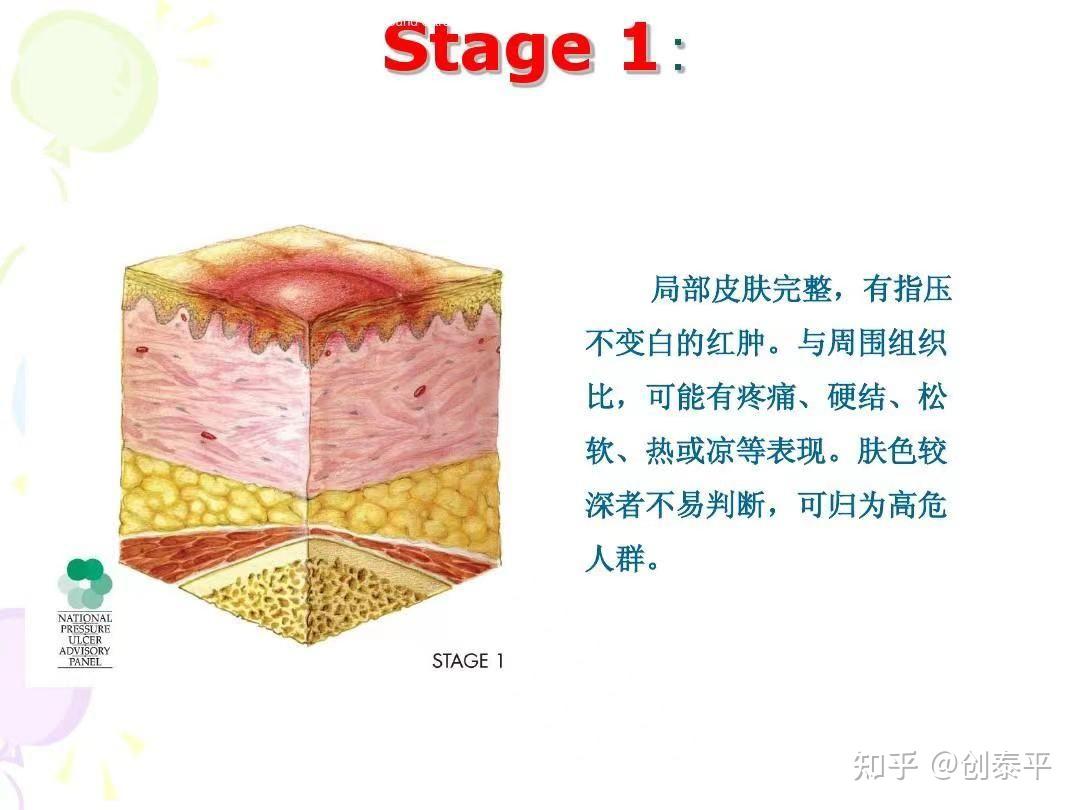 压疮(褥疮)的特点、分类及危害 - 知乎