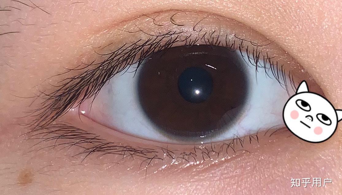 什么是双睫症?身边有这样的朋友吗?