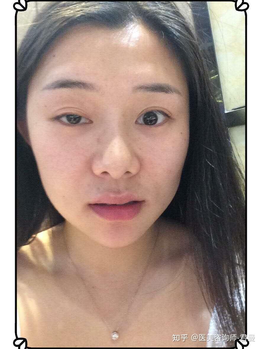 女孩子大小眼严重怎么办? - 知乎