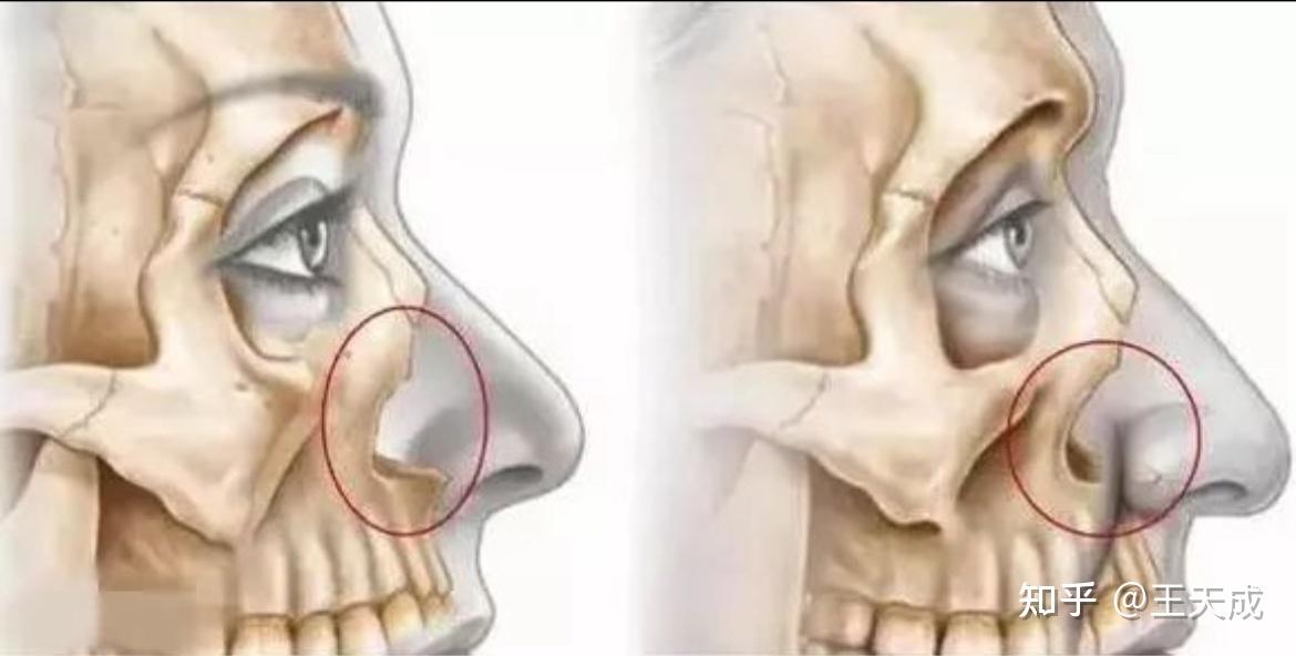 想知道这个是不是面中部凹陷