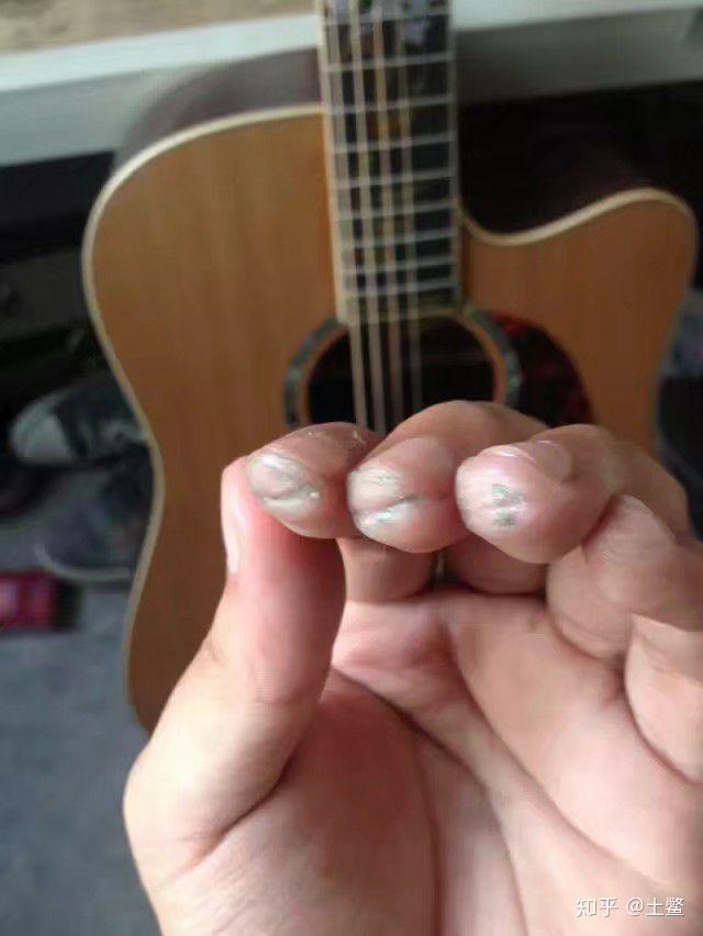 练吉他的时候左手按弦手指尖疼而且爆皮了怎么办