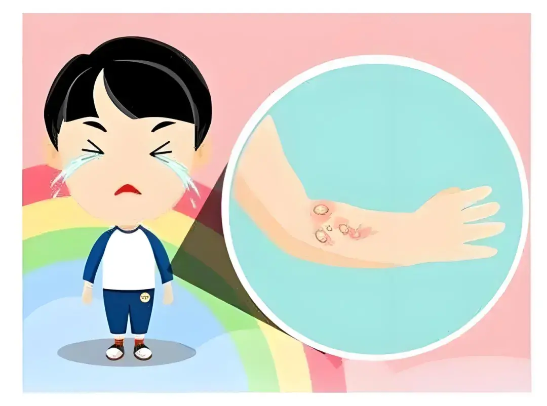 夏季伤口化脓了，正确处理很关键！ - 知乎