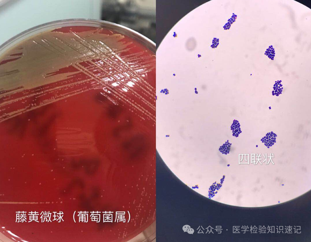 【临床实拍】细菌菌落图--肠球菌、微球菌 - 知乎