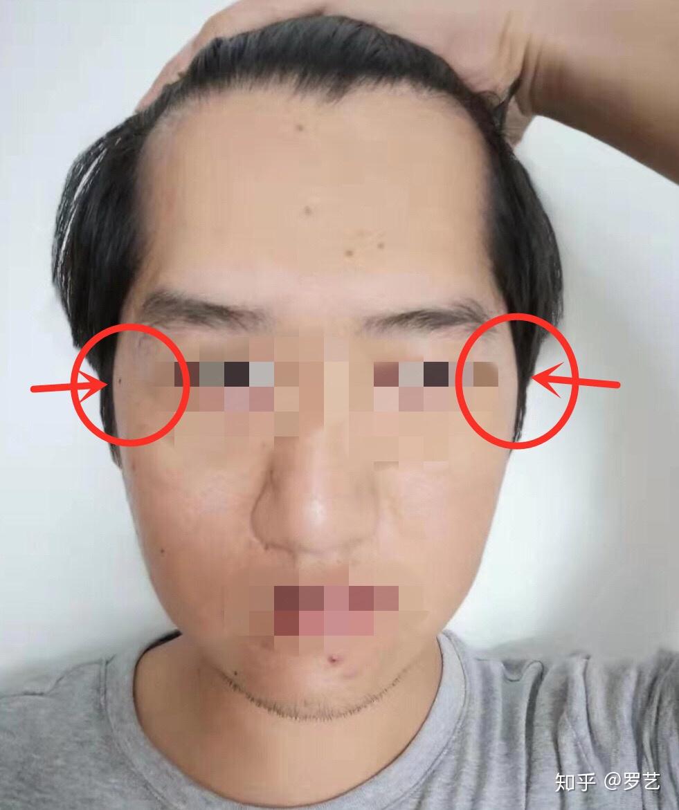 男生颧骨高有什么合适的短发发型推荐?