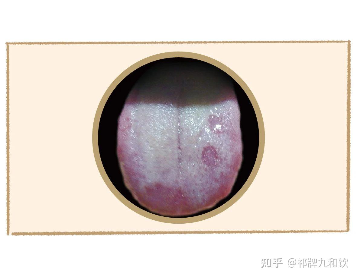 中医舌诊图谱来啦!看舌头知健康 通过舌象看看你是什么体质? - 知乎