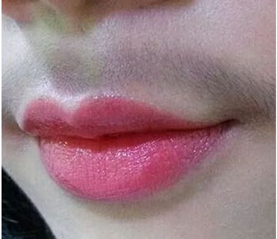 女孩子胡子越来越长怎么回事