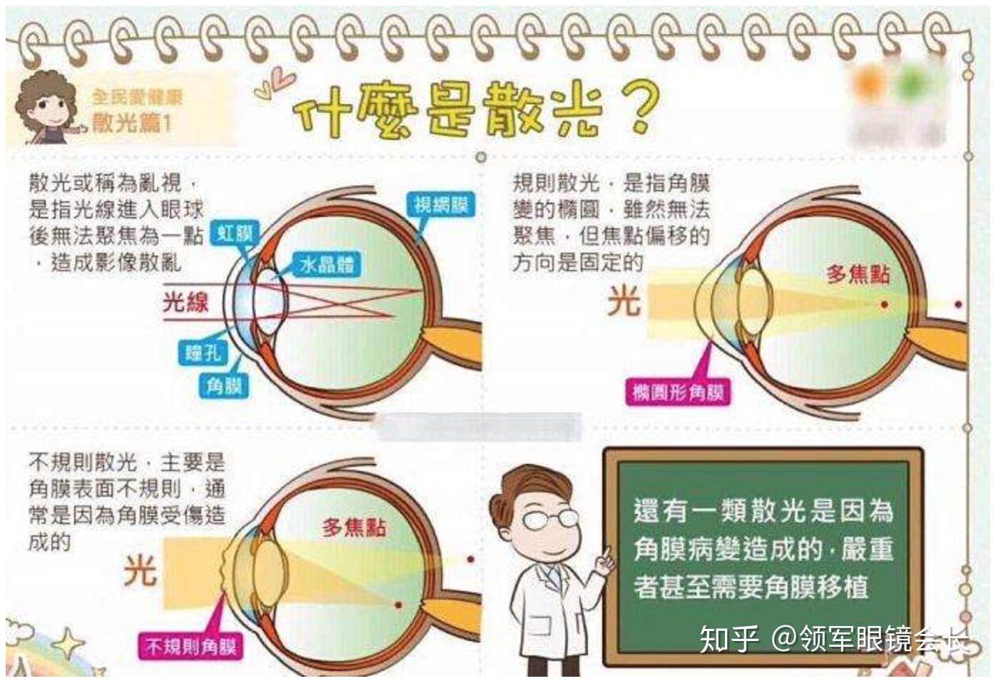 什么是「散光」,产生的原因是什么,如何预防? - 知乎