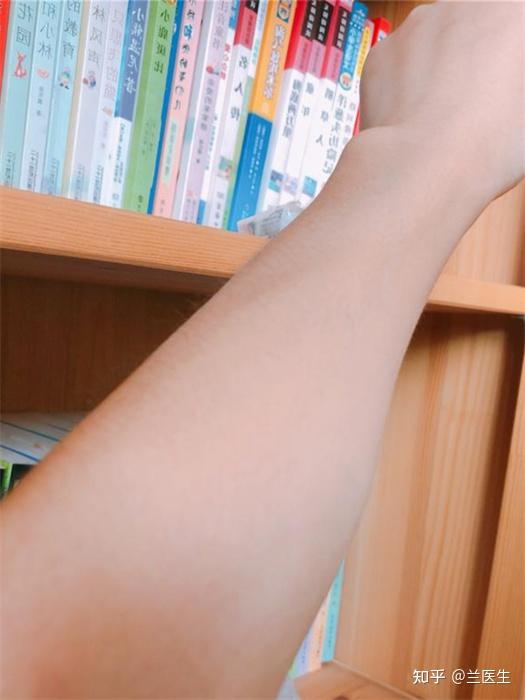 请问身上长红疙瘩并且很痒是怎么回事