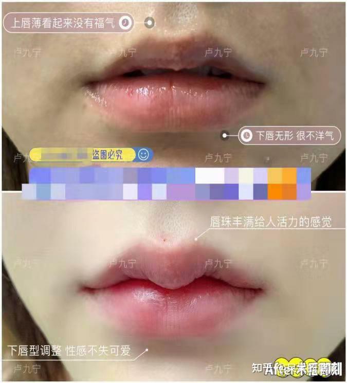 厚嘴唇的烦恼tt有没有厚嘴唇的姐妹