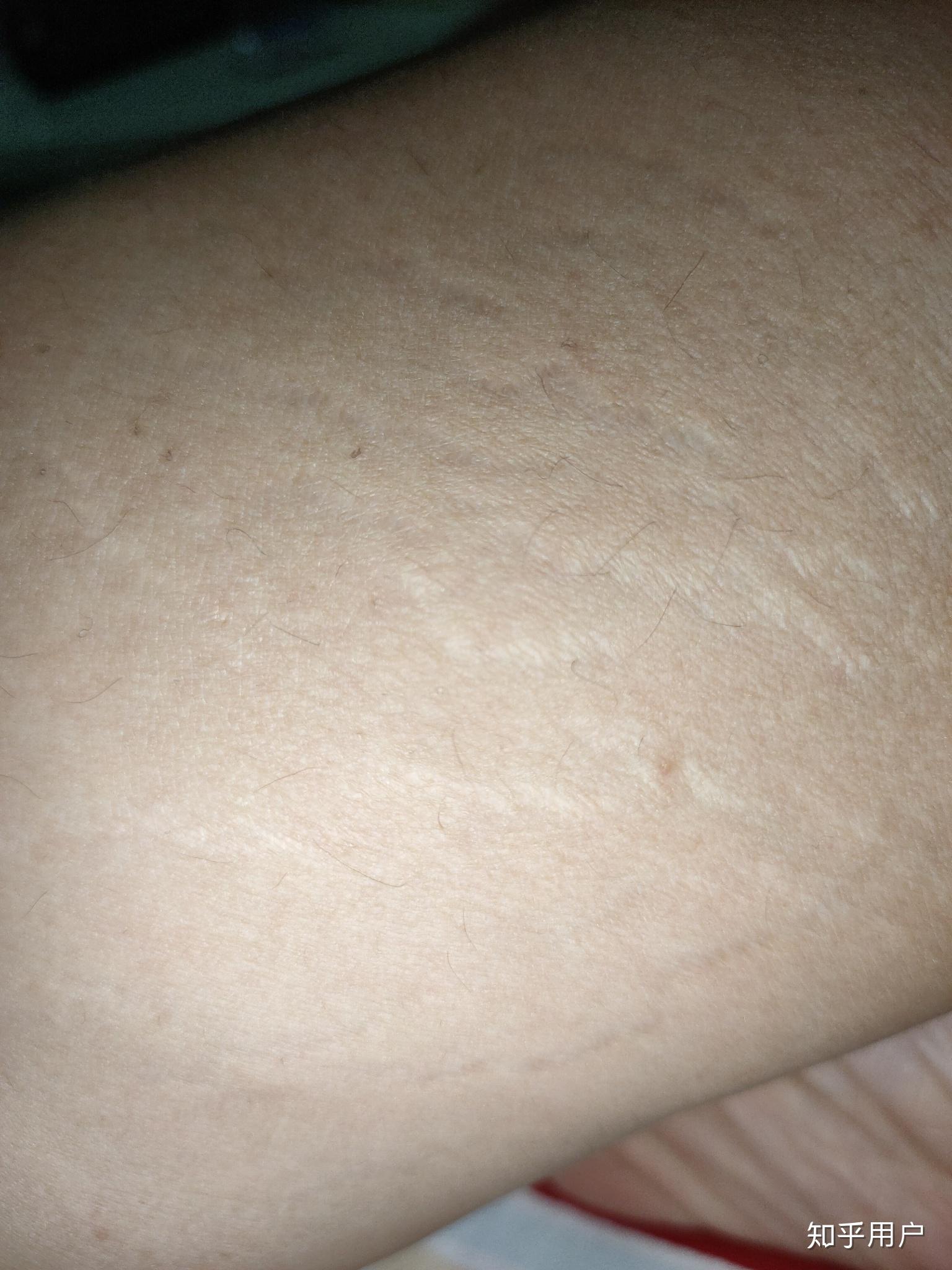 长生长纹是一种什么体验? - 知乎