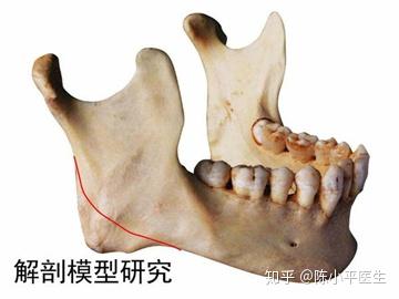 浅谈下颌角整形史,带你了解颌面手术技术发展 - 知乎