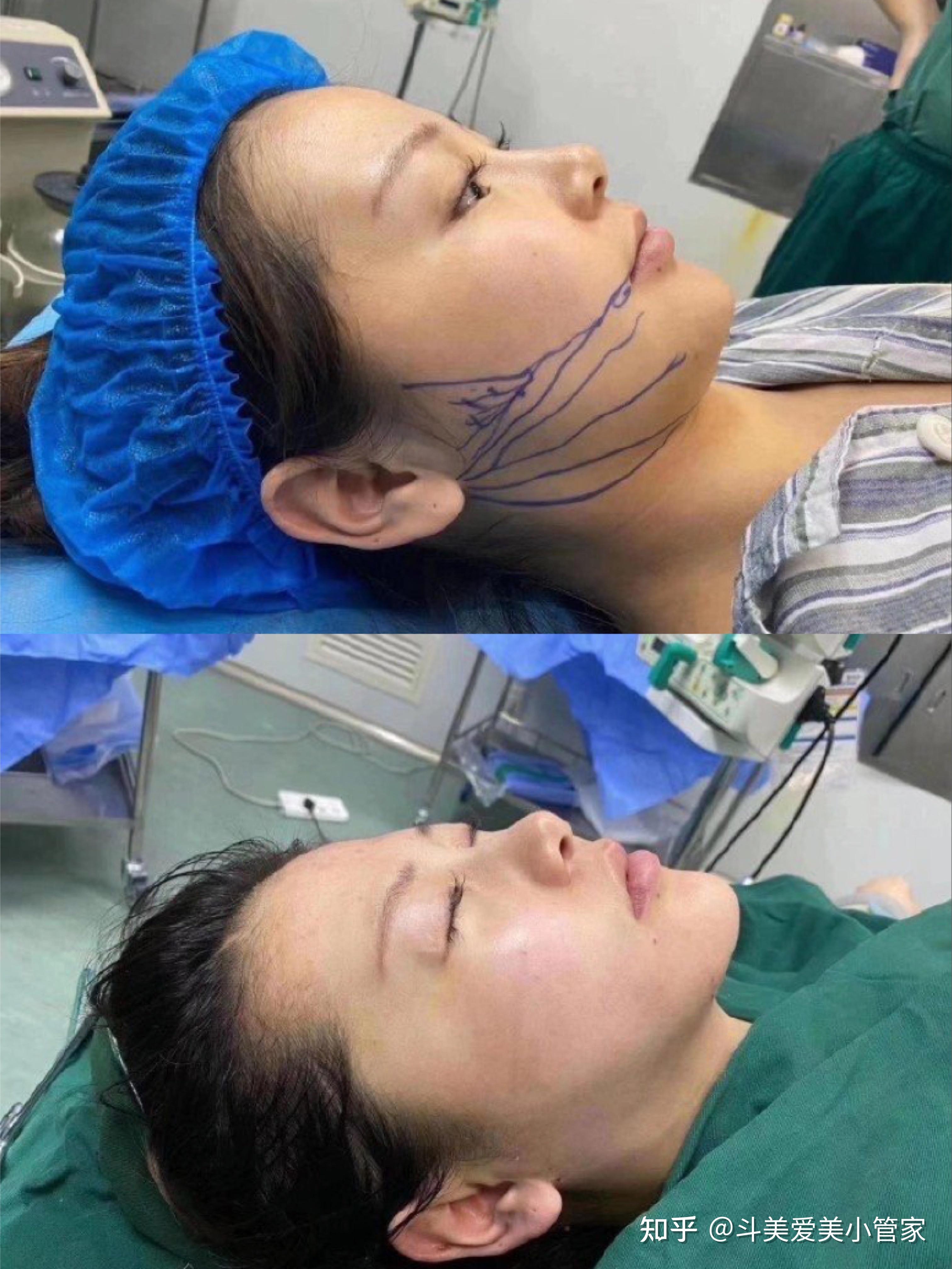 杭州有做黄金微雕好的医生吗