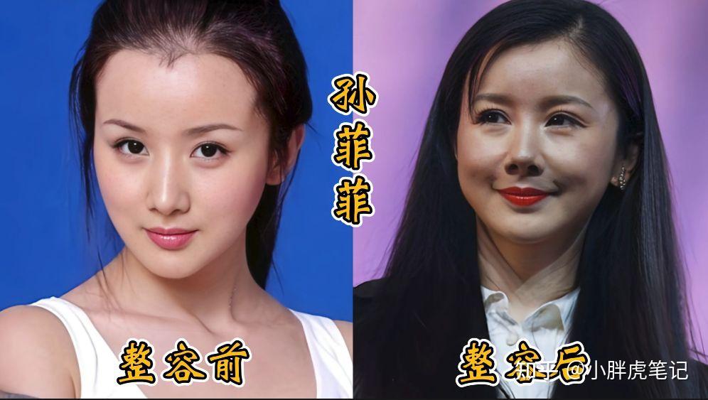 18位女明星整容前后对比，邵音音面目全非，杨颖堪称整容模板！ - 知乎