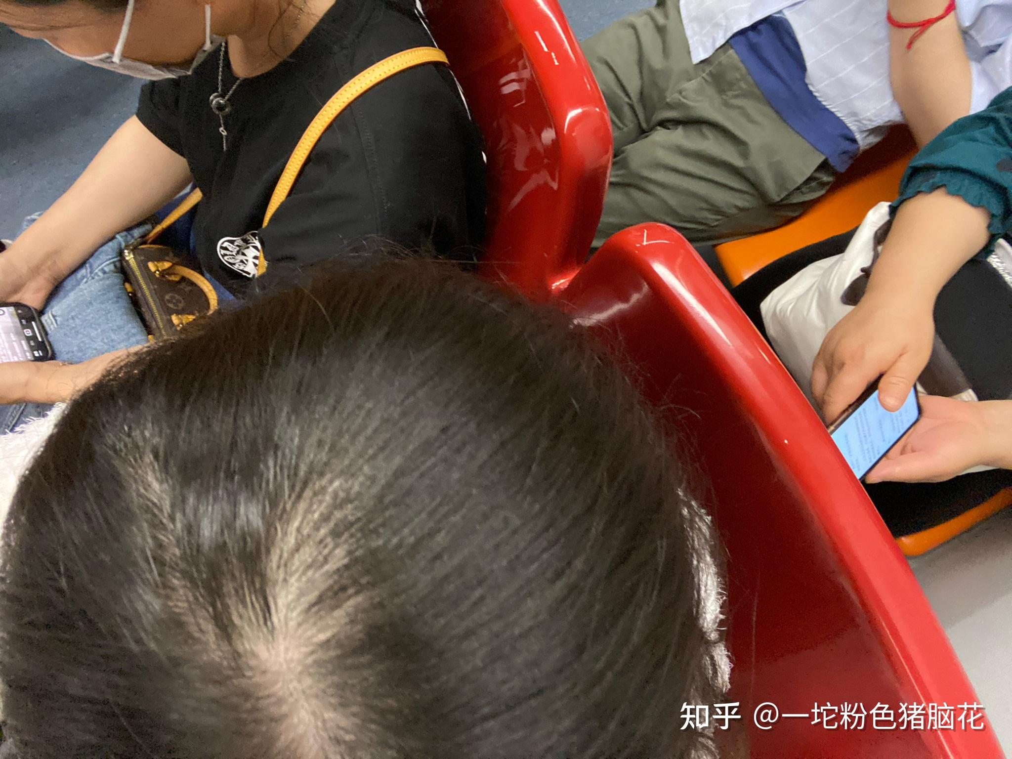 为什么很少见到有女生秃顶或者地中海