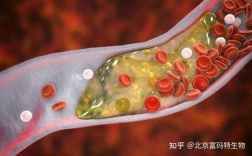 全面了解代谢综合征的治疗方法 - 知乎