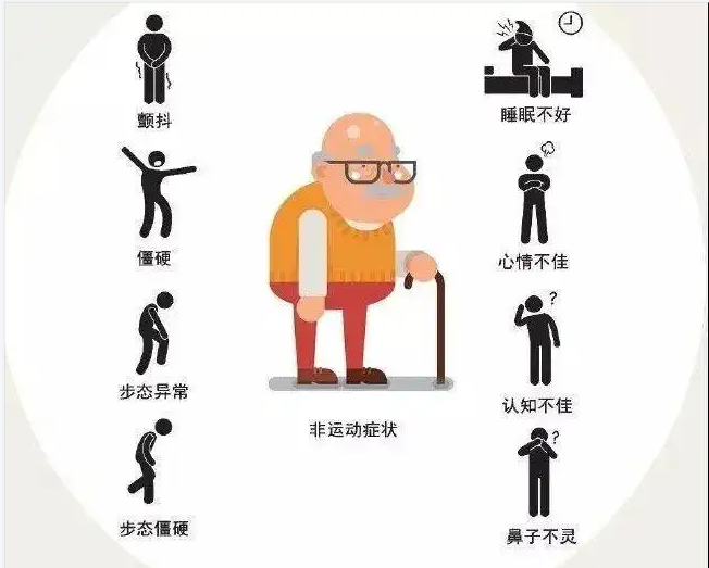 什么是特发性震颤? - 知乎
