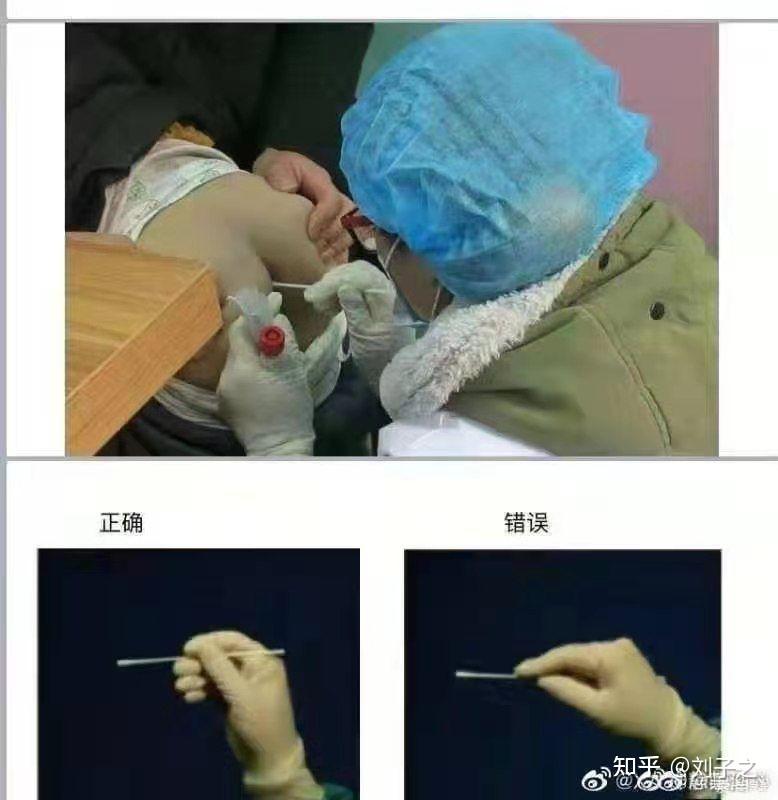 接受肛拭子采样是怎样的体验? 