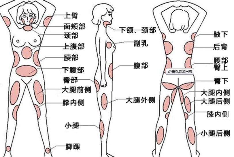 打瘦腿针或者腿部抽脂有用吗