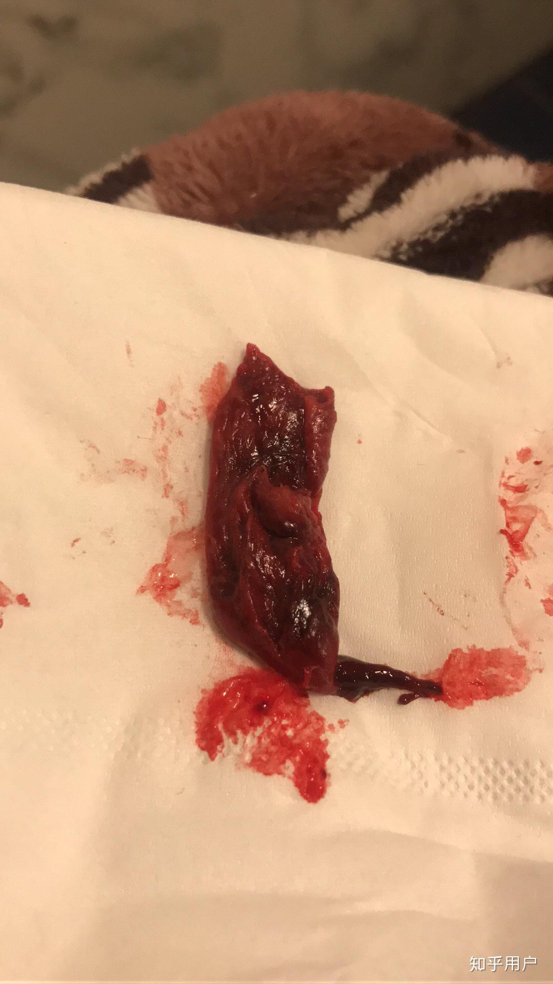 为什么子宫内膜脱落是以血的形式而不是血块? - 知乎