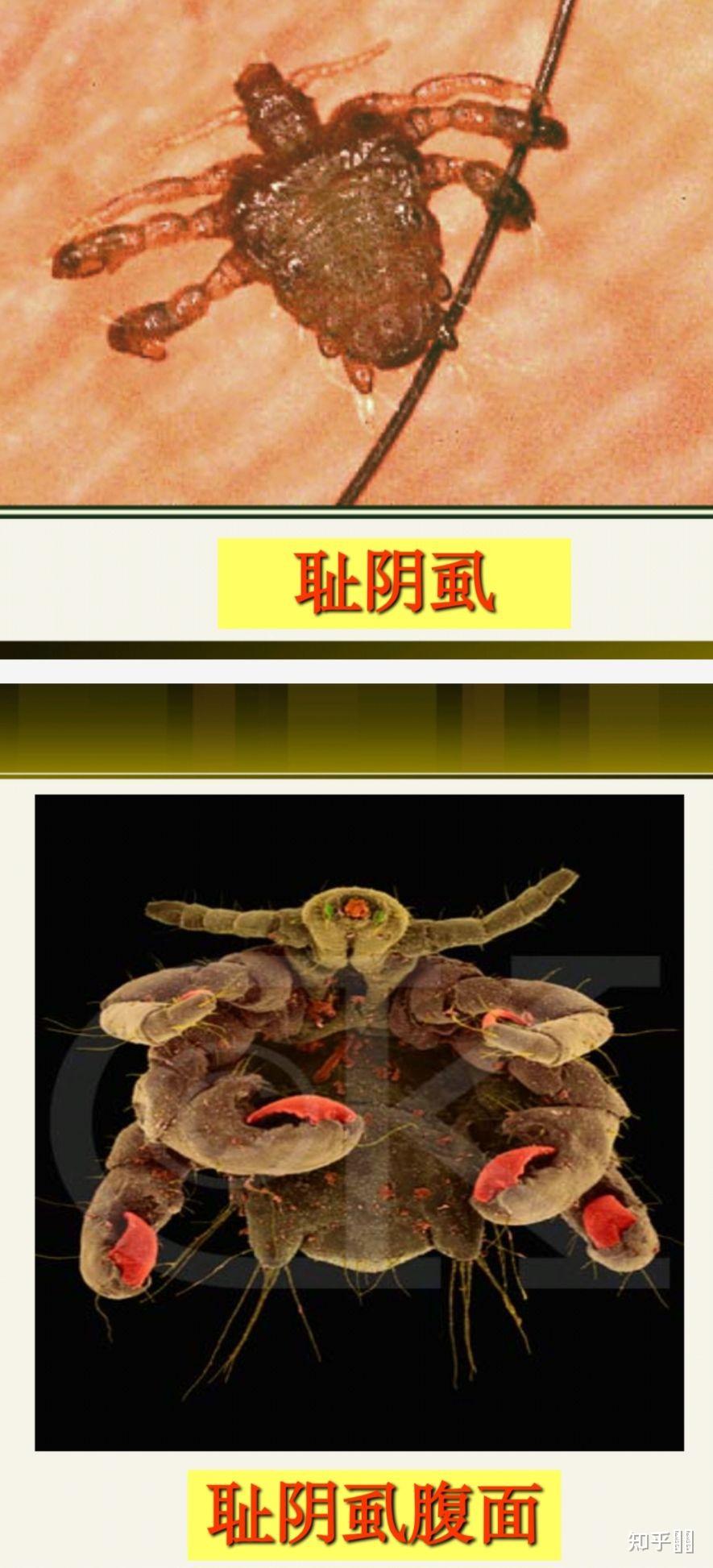 谁知道这个是什么东东,长在我朋友阴毛上和附在阴茎边的肉体上?