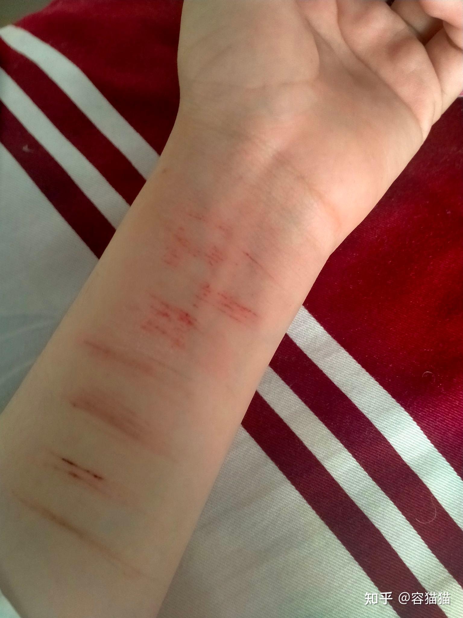 不是很懂,为什么初中生喜欢拿刀在胳膊上画?