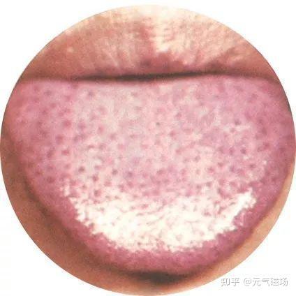 中医舌诊(一)高清版 - 知乎