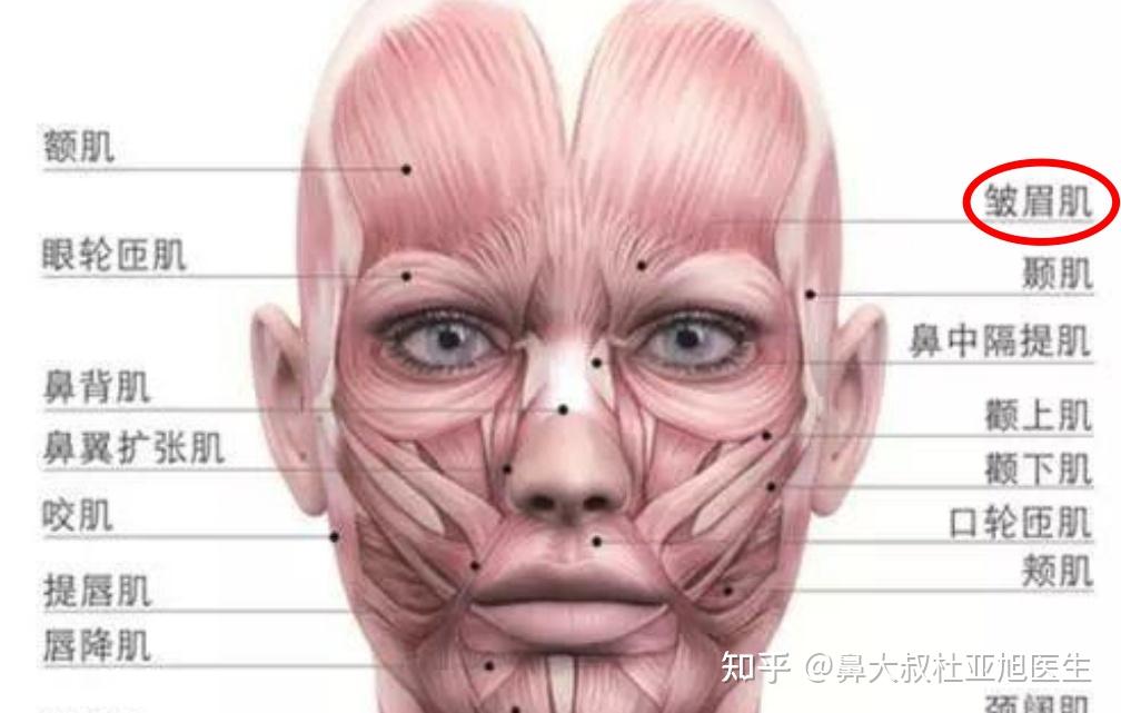 川字纹是怎么引起的? - 知乎