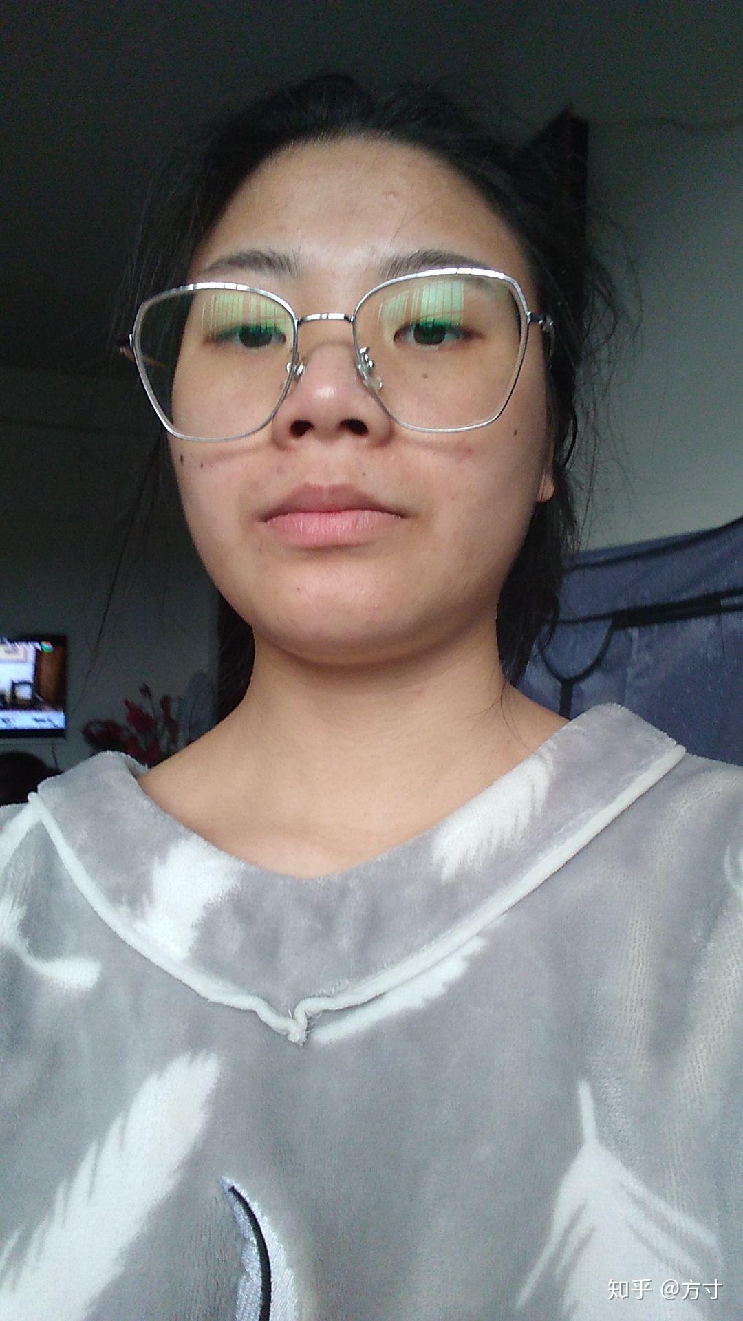 女生长得特别丑怎么办