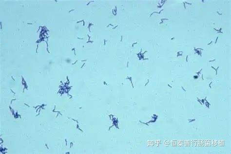 肠杆菌科多样化菌属——Eubacterium（真/优杆菌属） - 知乎