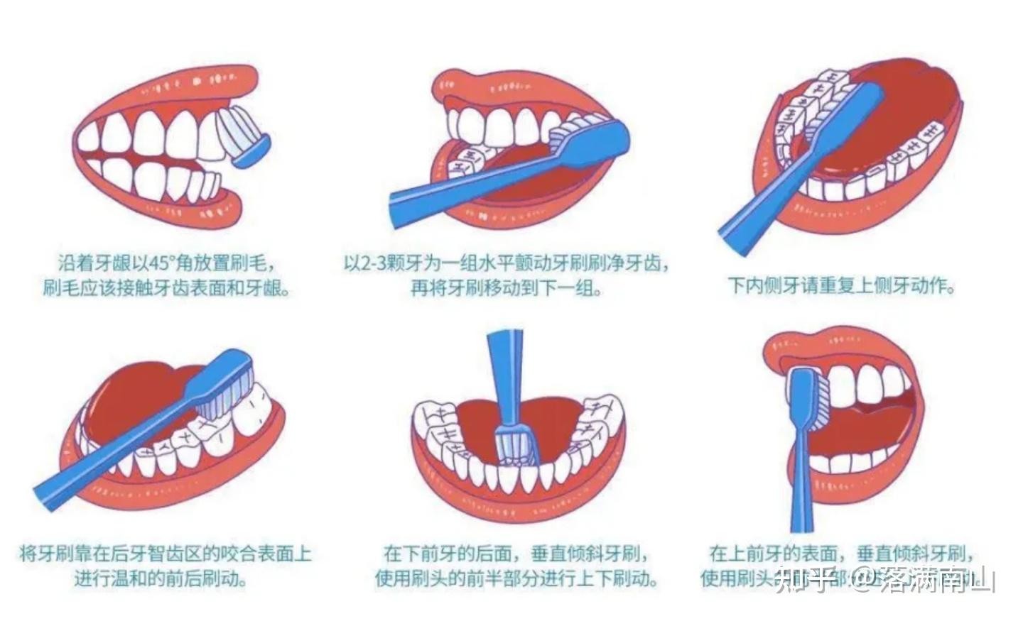 电动牙刷到底好不好?