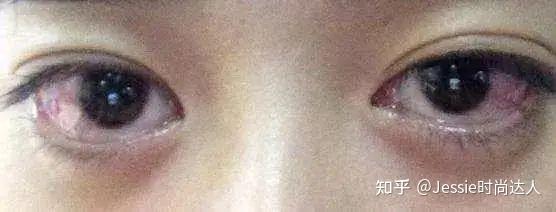 到底要不要用洗眼液?多人试用,效果惊掉下巴:这么脏是认真的吗? - 知乎